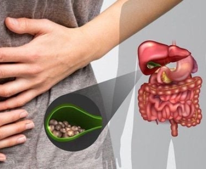 Những yếu tố nguy cơ nào làm tăng khả năng bị sỏi mật?